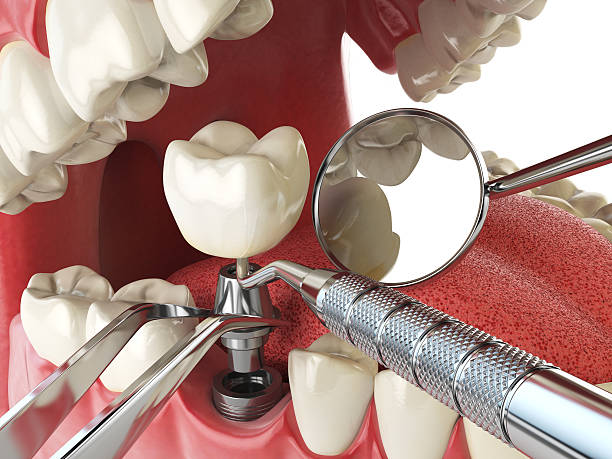 Best Urgent Tooth Repair  in Youngwood, PA